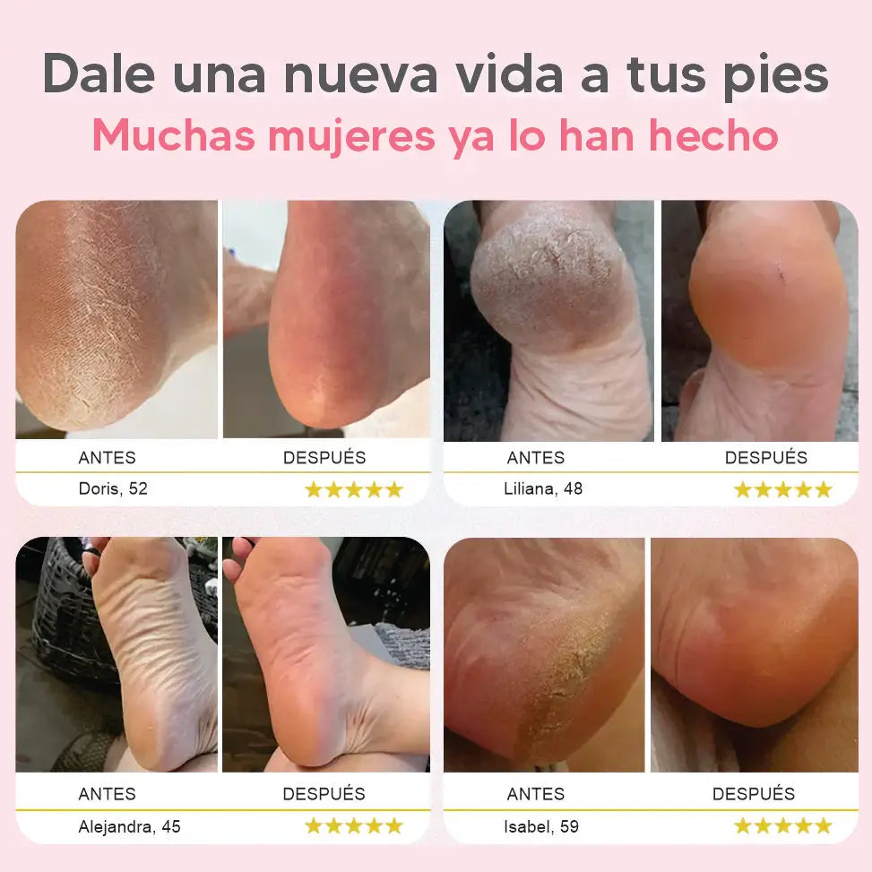 Removedor de callos | GRATIS piedra exfoliante para piernas