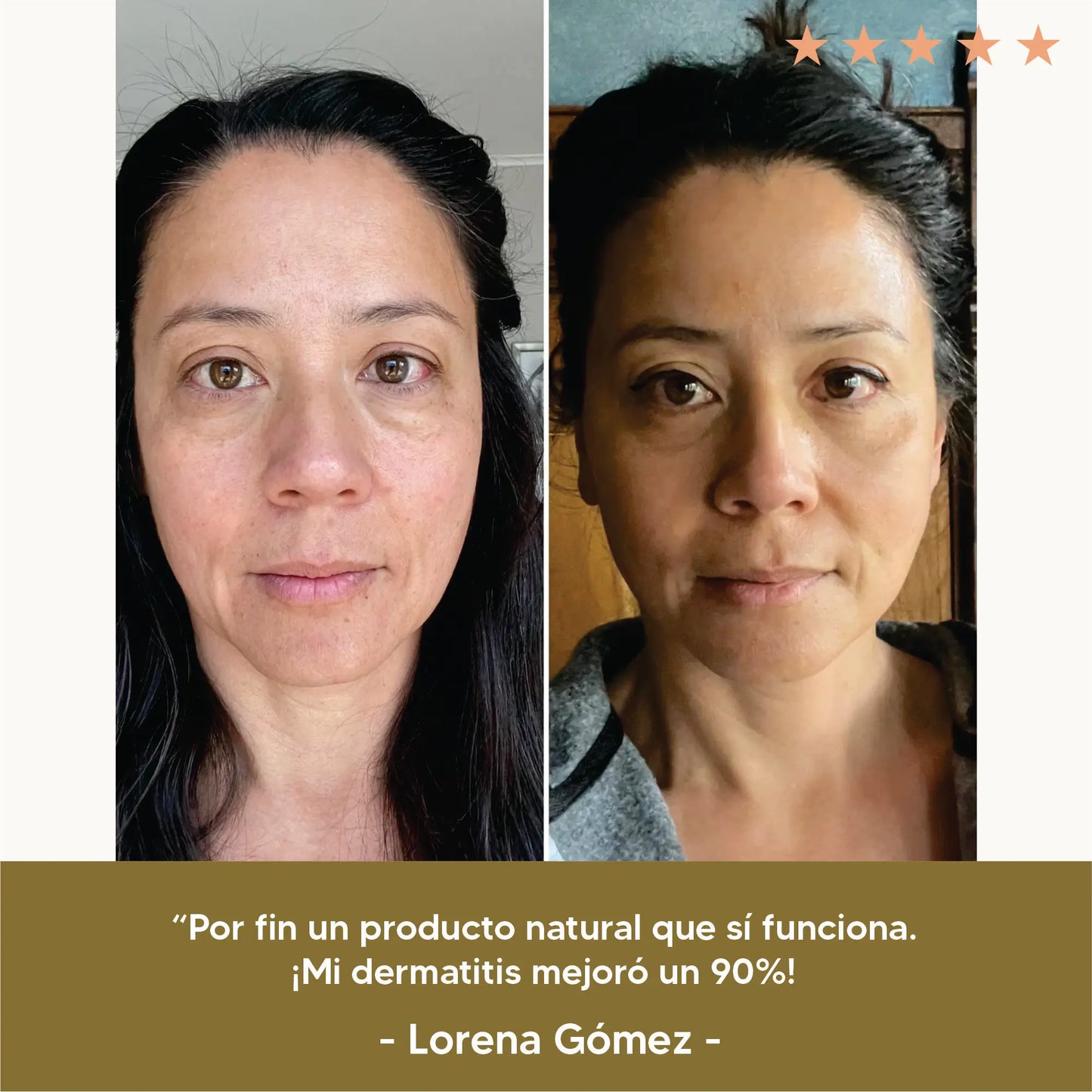 Bálsamo Hidratante de Sebo de Res y Miel de Manuka | Hidratación profunda | PAGA 1 LLEVA 2