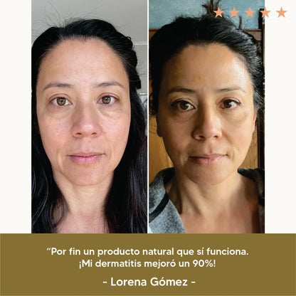 Bálsamo Hidratante de Sebo de Res y Miel de Manuka | Hidratación profunda | PAGA 1 LLEVA 2