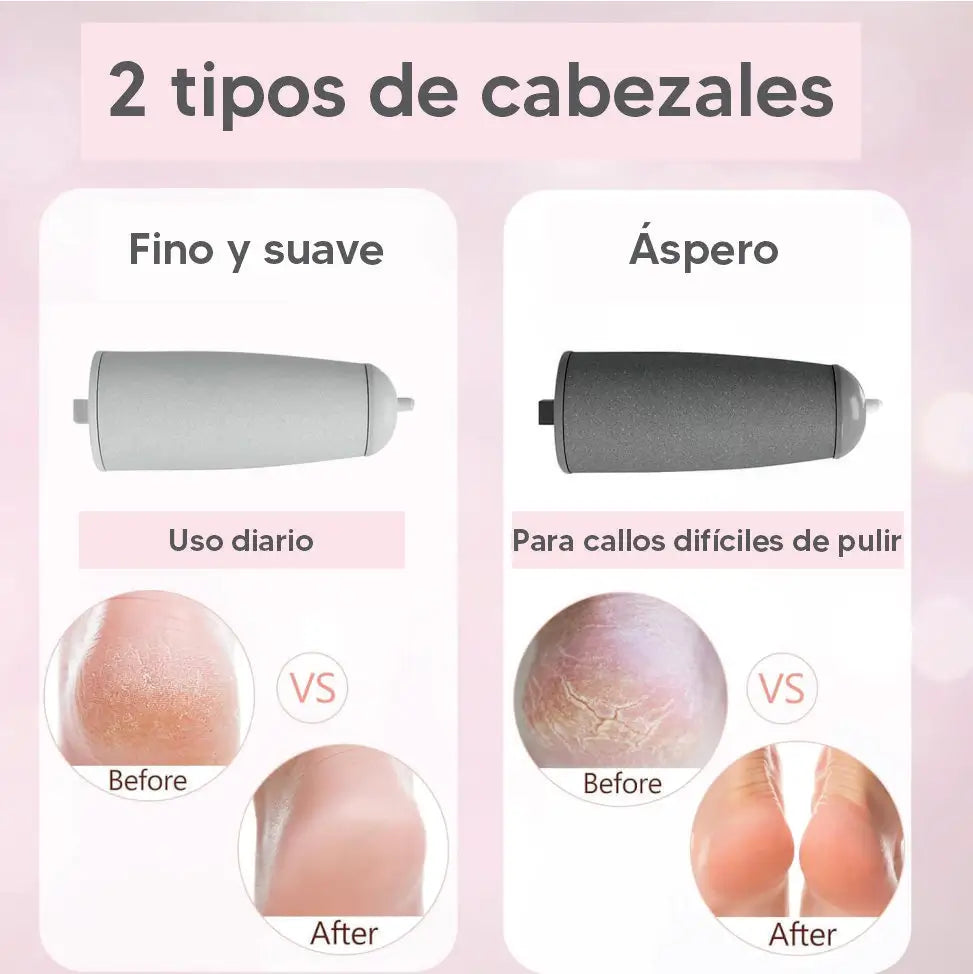 Removedor de callos | GRATIS piedra exfoliante para piernas