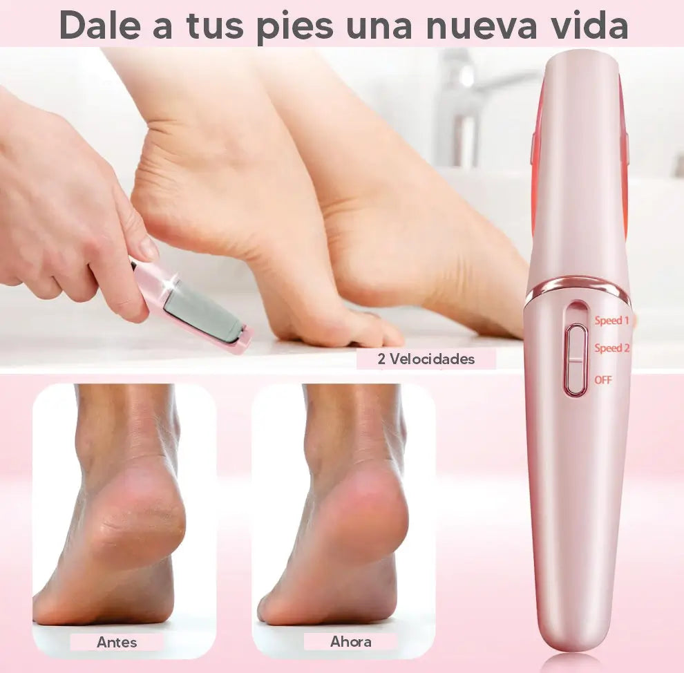 Removedor de callos | GRATIS piedra exfoliante para piernas